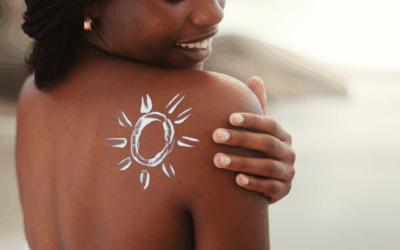 The cancer myth that puts darker skin at risk